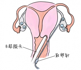 幼儿学画画，潍坊捐卵宝宝学画画，学画画的好处，如何学画画