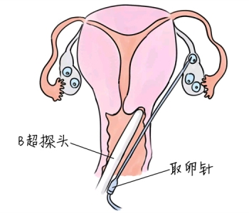 幼儿学画画，潍坊捐卵宝宝学画画，学画画的好处，如何学画画